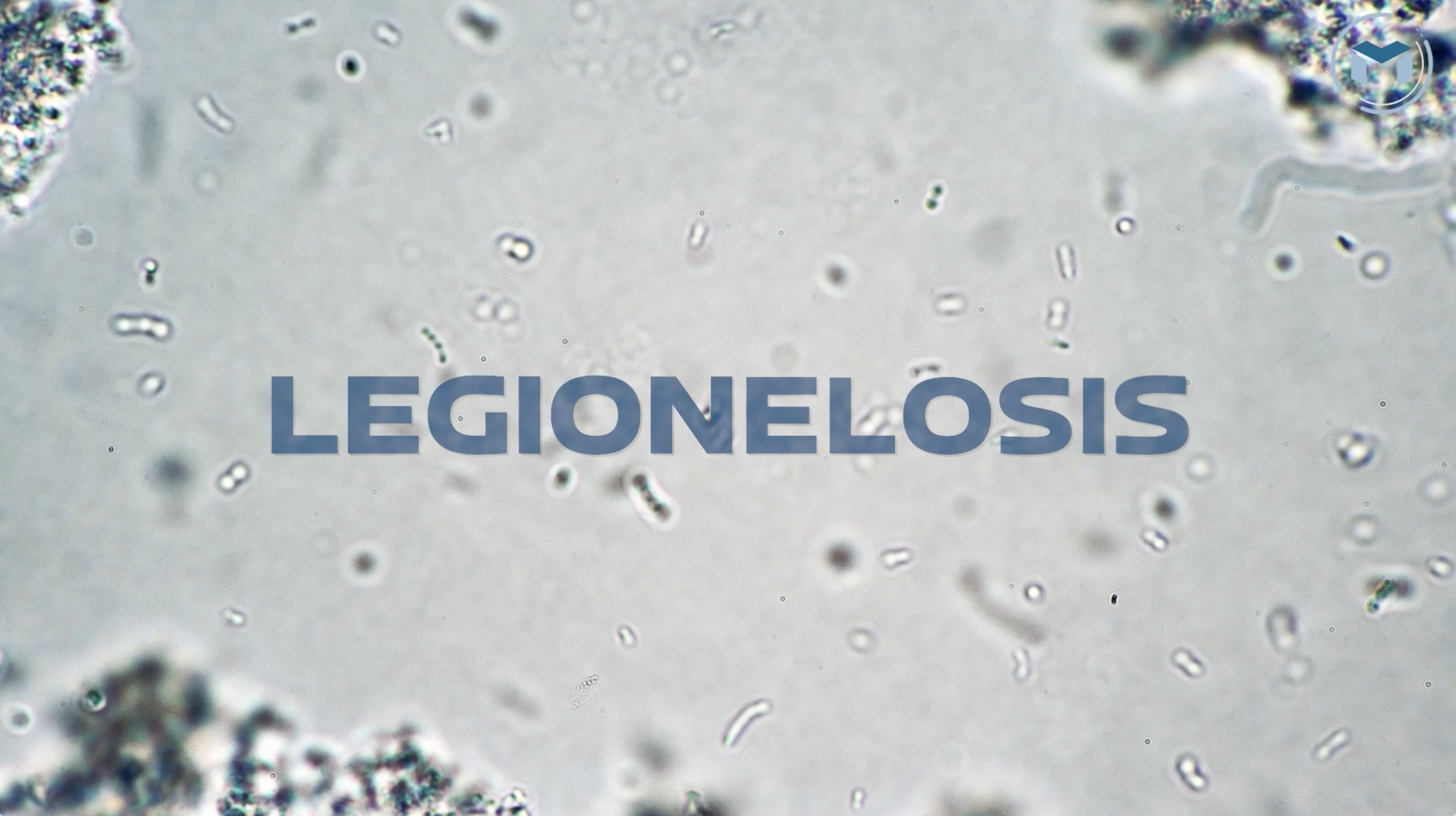 Legionela: prevención y control del riesgo en el entorno laboral